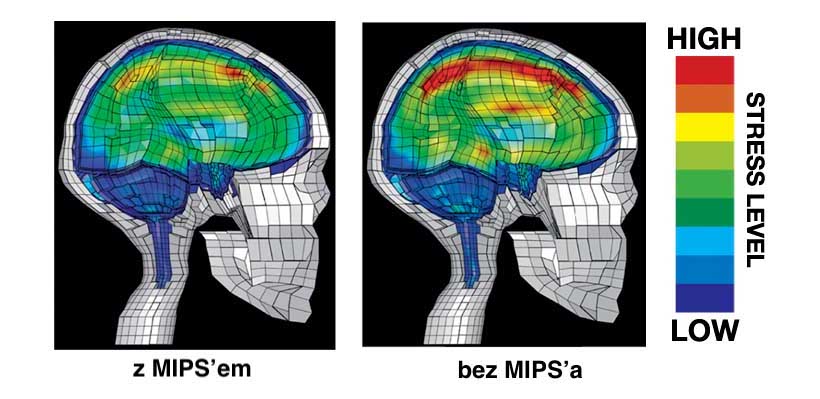 Porównanie uszkodzeń głowy bez i z MIPS